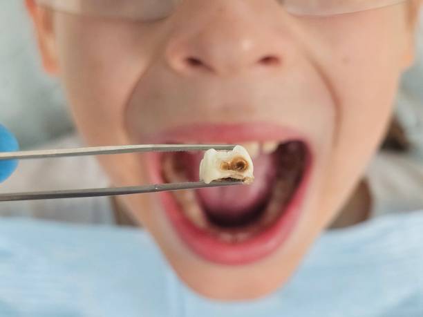 Best Weekend Emergency Dentist in Four Corners, TX
