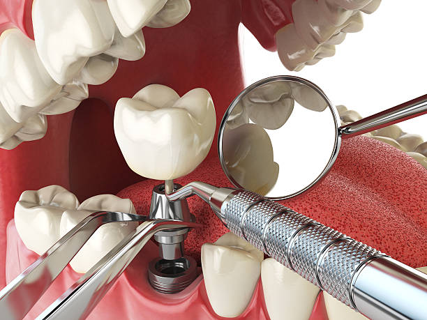 Best Cosmetic Emergency Dentistry in Four Corners, TX